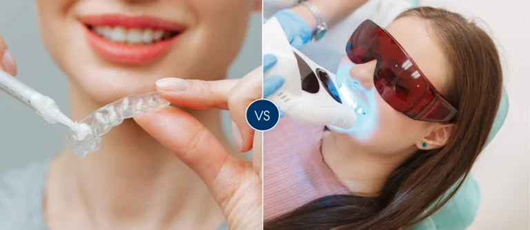 teeth whitening img